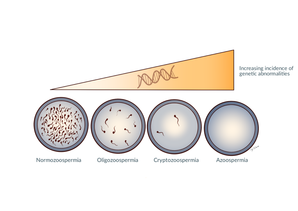 genetic-aspects-of-male-infertility-andrology-awareness-europe