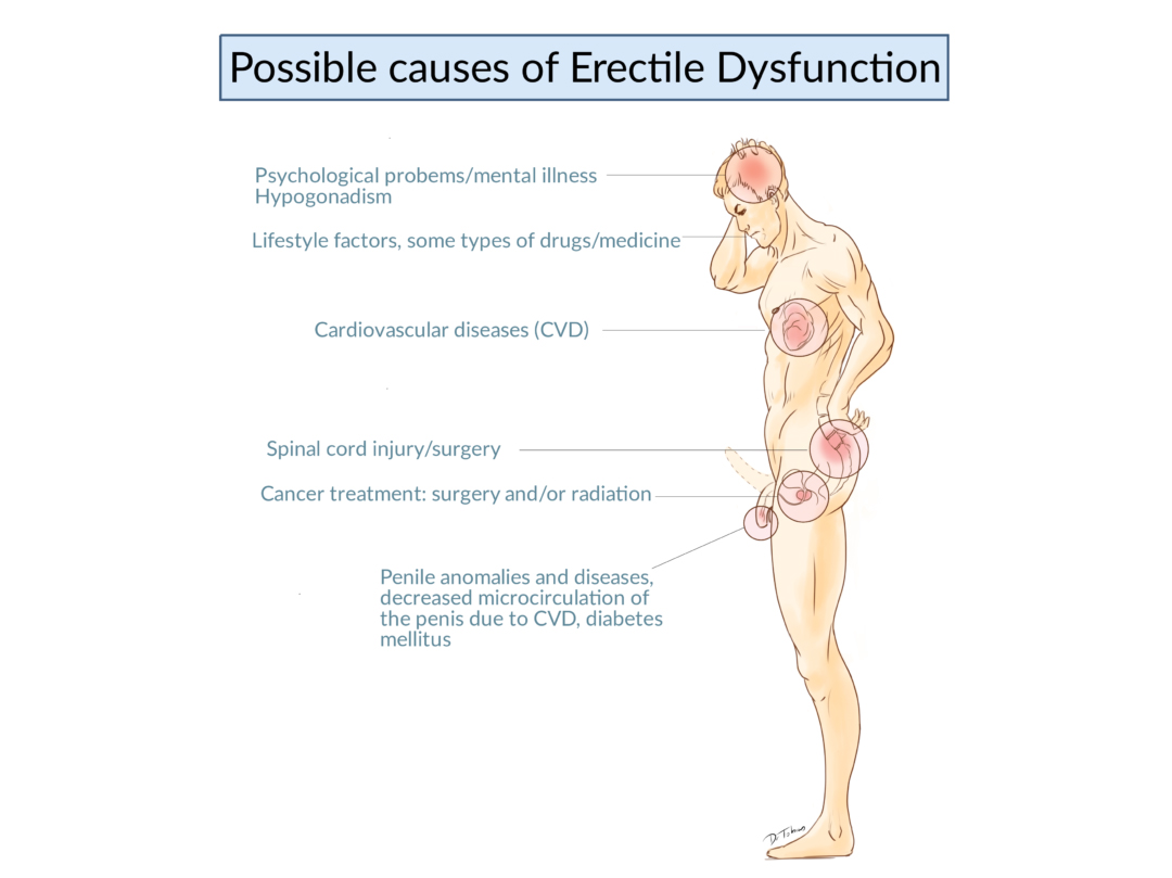 Do Erectile Dysfunction/ED Interventions Cause Priapism?