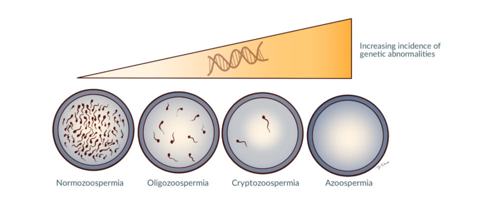 Genetic Aspects Of Male Infertility Andrology Awareness Europe 